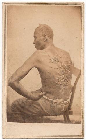 Gordon seated, photo of his back scarred from whipping